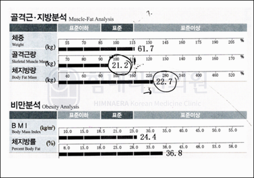 Before 이미지