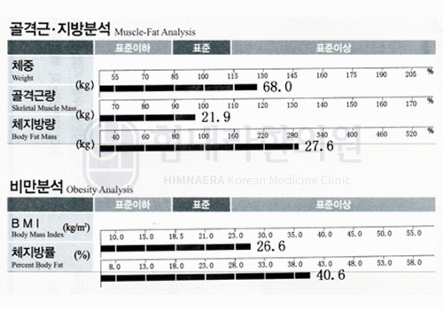 After 이미지