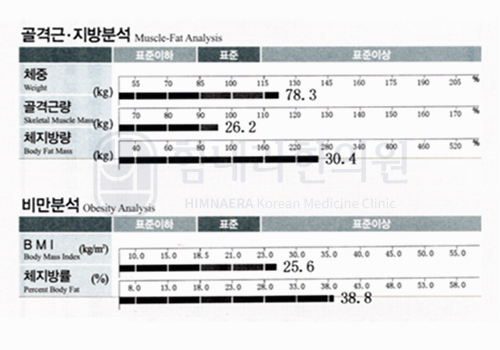 Before 이미지