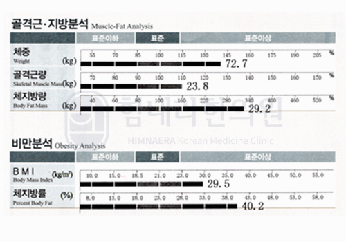 Before 이미지
