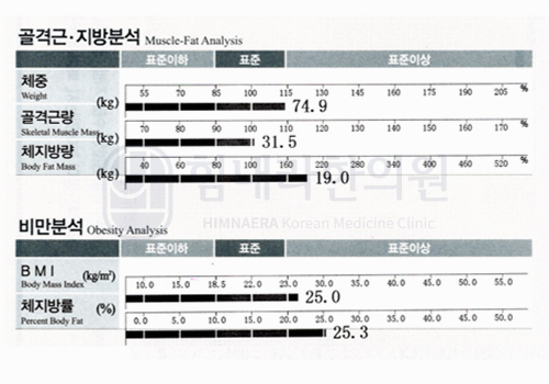 Before 이미지