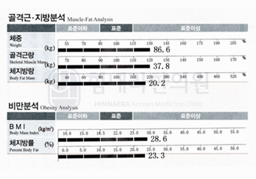 After 이미지